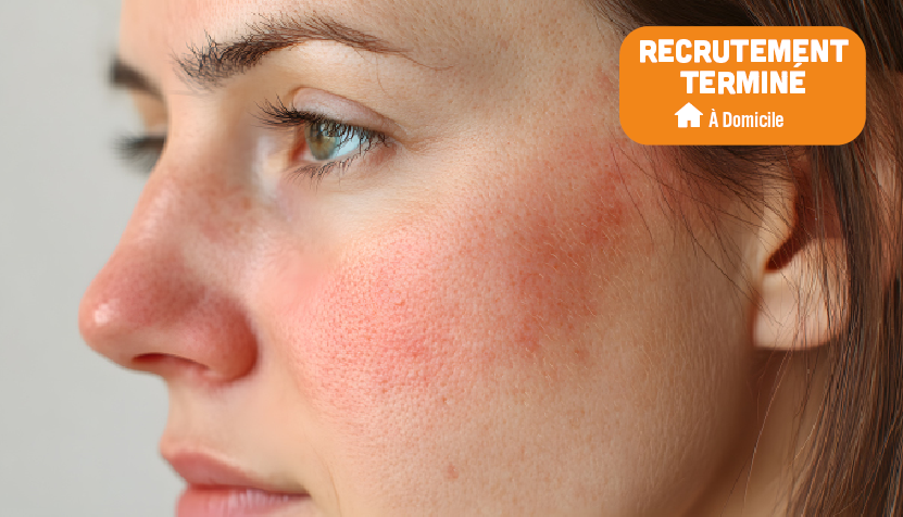 Prenez soin de votre peau en testant notre sérum !