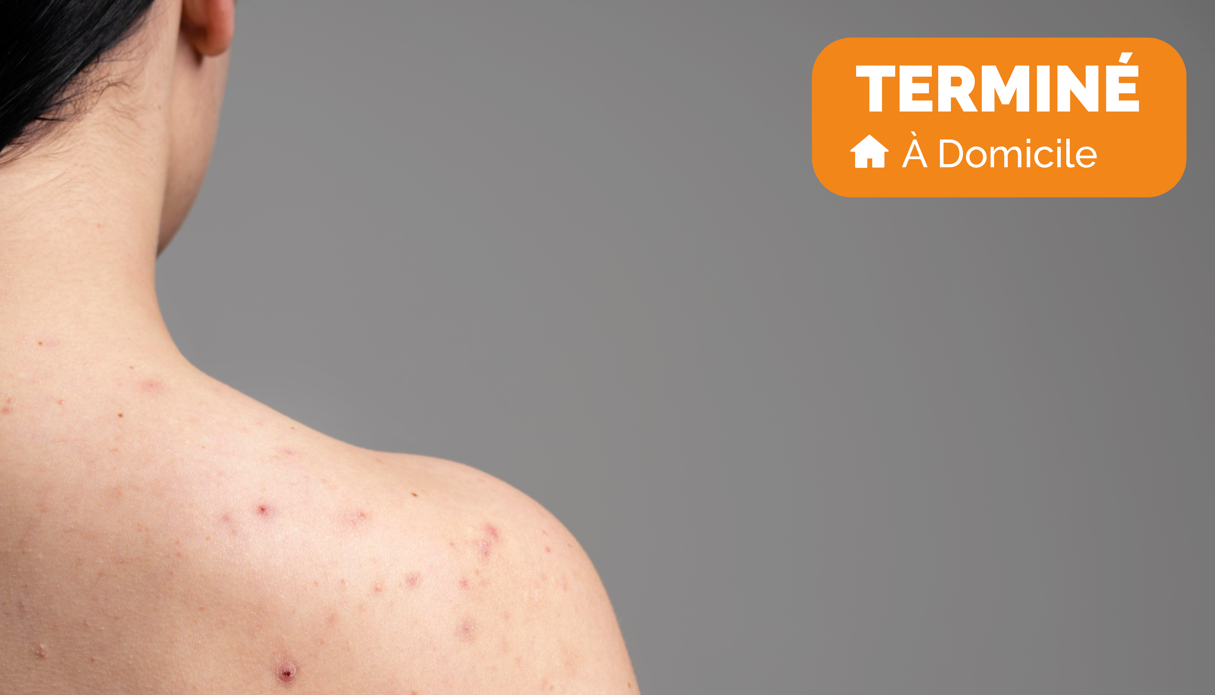 Testez un spray anti-imperfection !